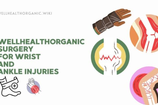 wellhealthorganic surgery for wrist and ankle injuries